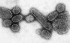 Virionen des rekonstruierten Virus der Spanischen Grippe - Foto: Public Health Image Library, Cynthia Goldsmith